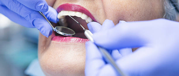 Best Emergency Gum Treatment in Kempner, TX